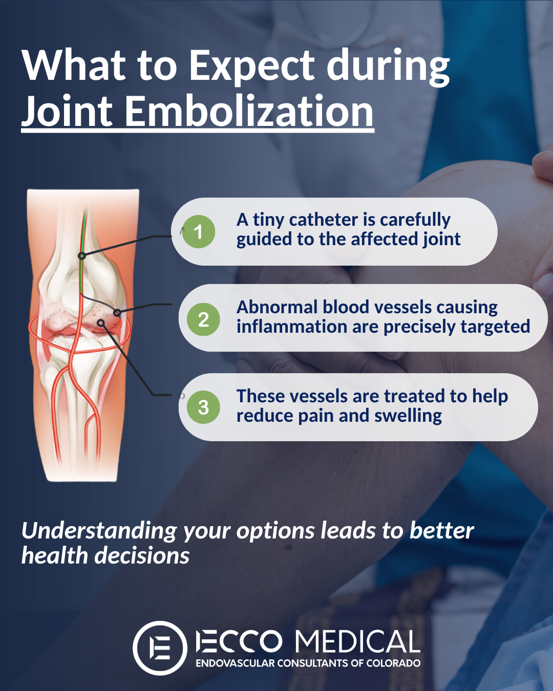 ECCO Medical - Joint Embolization Infographic