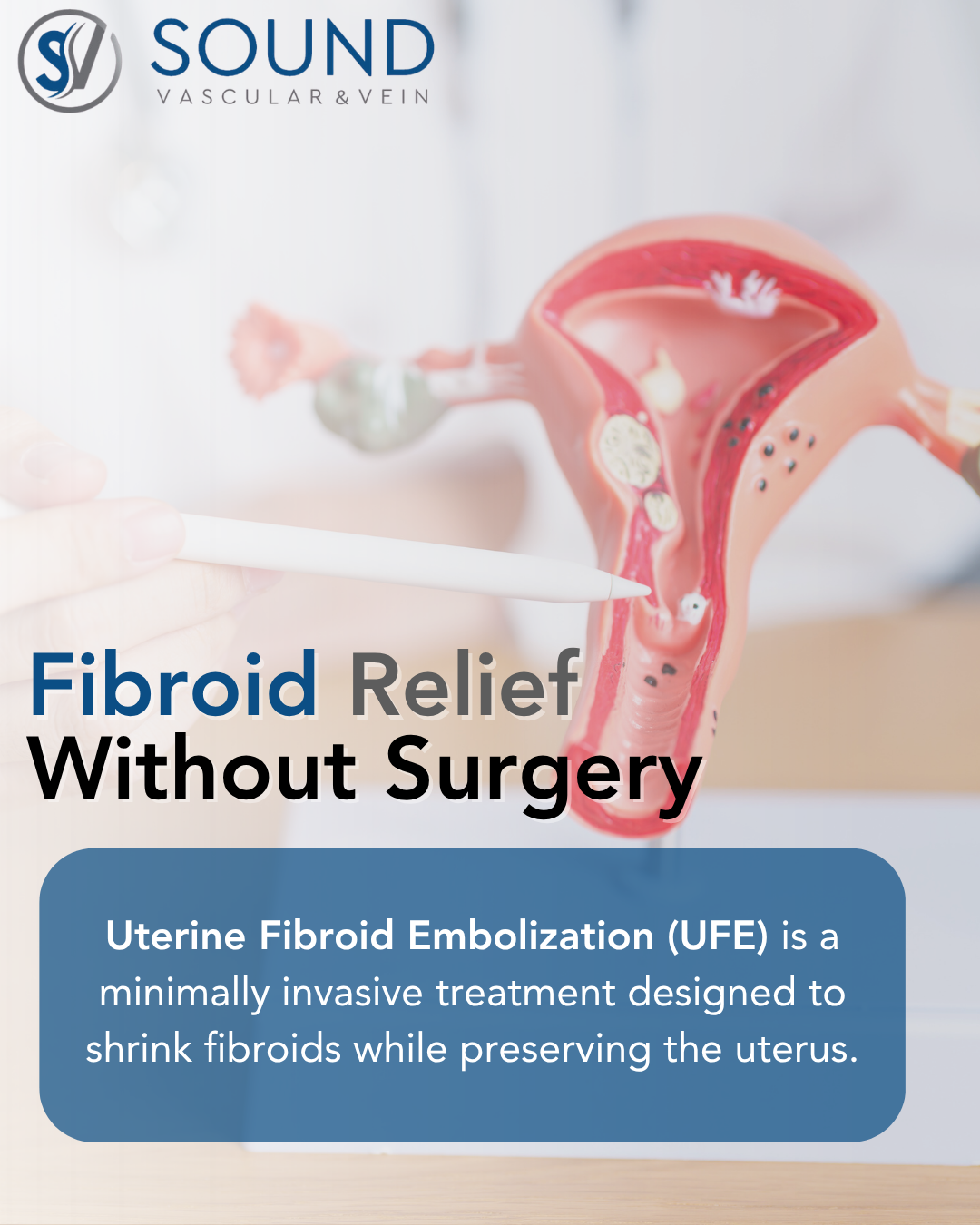Sound Vascular - Fibroid Relief Without Surgery