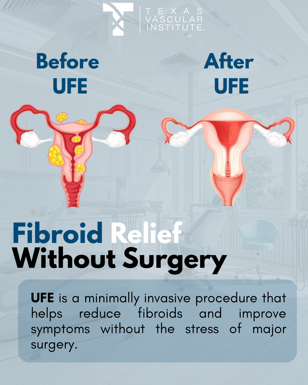 TVI - Before After UFE